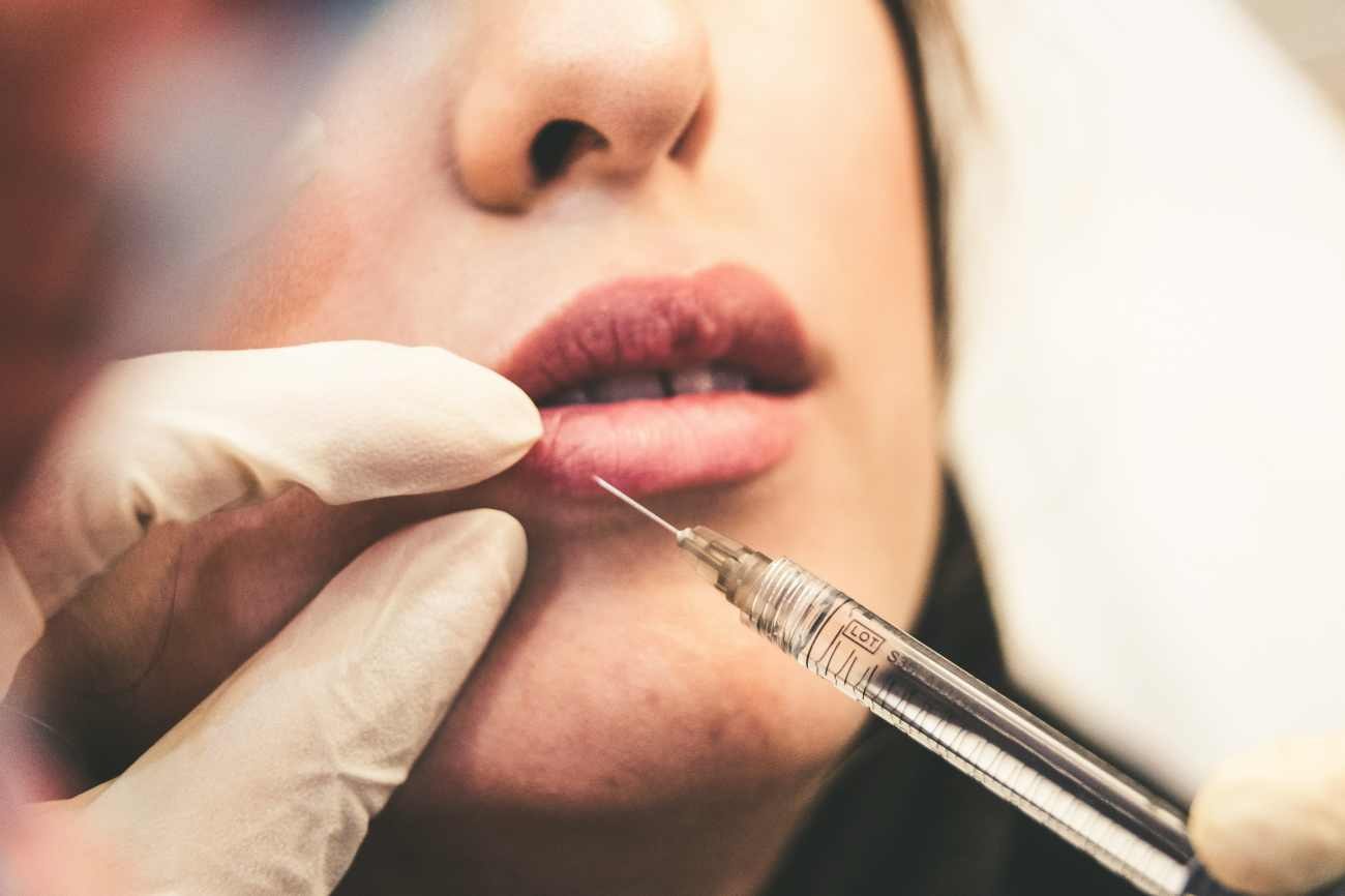 Labbra più grandi: cosa sapere prima di ricorrere alle punture